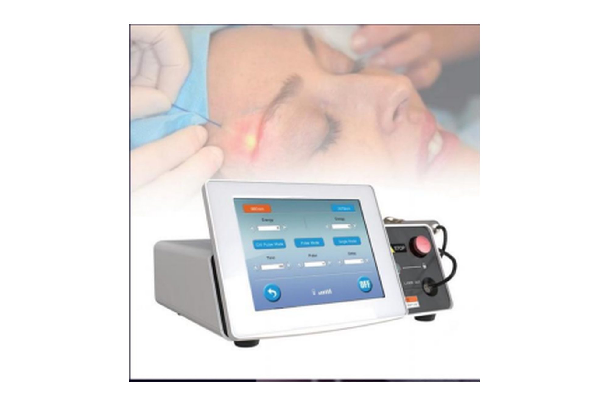 980+1470nm Diode Laser Lipolysis